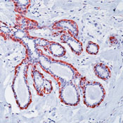      / Calponin Ab-1