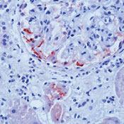        / Amyloid A Component Ab-1