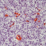        / Pancreatic Polypeptide Ab-1  