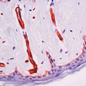      B2 / 1 / Laminin B2 / gamma1 Ab-2