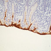     MUC5 / Mucin 5AC (MUC5AC) / Gastric Mucin Ab-1