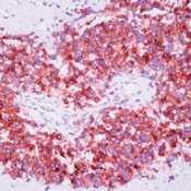     CD99 / MIC2 (  )  / CD99 / MIC2 (Ewing’s Sarcoma Marker) Ab-2