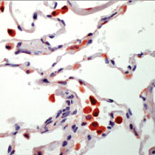         / Tartrate Resistant Acid Phosphatase (TRAP)Ab-1