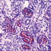       1 (WT1)  / Wilm’s Tumor Protein (WT1) Ab-5  