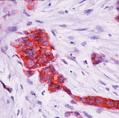     'pS2 / pNR-2 -  / pS2 / pNR-2 Estrogen-Regulated Protein Ab-2