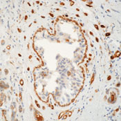      II  / Transglutaminase II Ab-1