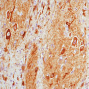     MAP / MAP 2a,b,c (Microtubule-Associated Protein) Ab-3