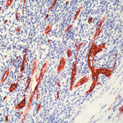       VIII / Factor VIII Related Antigen / von Willebrand Factor Ab-1