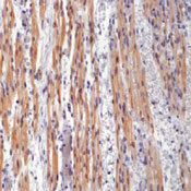      / Troponin T, Cardiac Isoform Ab-1