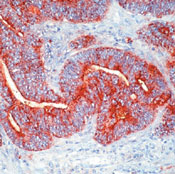       / CEA (Carcinoembryonic Antigen) / CD66e Ab-2