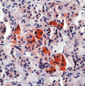       /  Adrenocorticotrophic Hormone (ACTH) Ab-1 