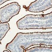     CD10 / CD10/CALLA (Neutral Endopeptidase) Ab-2 