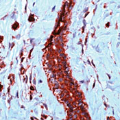         / Vascular Endothelial Growth Factor (VEGF)