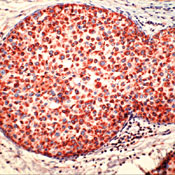        / Cathepsin D 