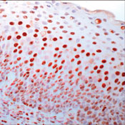      PCNA / PCNA (Proliferating Cell Nuclear Antigen).