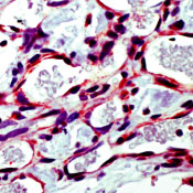     VEGF / Vascular Endothelial Growth Factor (VEGF) . 