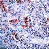       / Adrenocorticotrophic Hormone (ACTH).