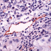     eNOS / Nitric Oxide Synthase, endothelial (eNOS)