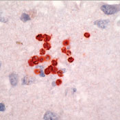       / Toxoplasma Gondii.