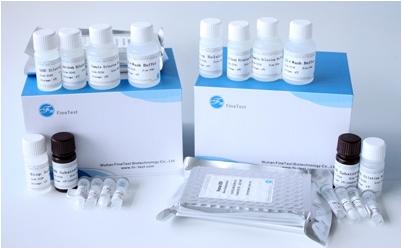Human PKP3 (Plakophilin 3) ELISA Kit