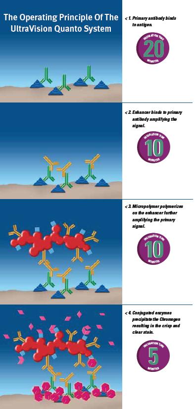 Operating Principle UltraVision Quanto System