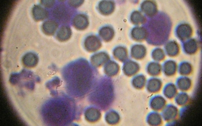 Лейкоциты (лейкоцитарная масса)